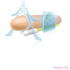 ANDROPENIS MINI - PENIS EXTENDER